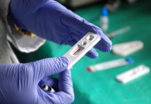 Pruebas rápidas gratuitas de VIH en Sanse: La ciudad organiza una semana de prevención y talleres